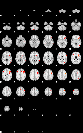 Patients 29575 191