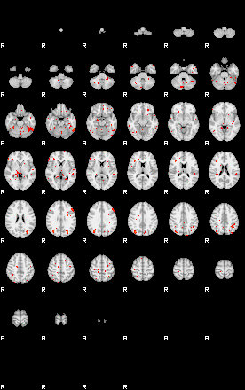 Patients 29609 4