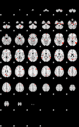 Patients 29613 13