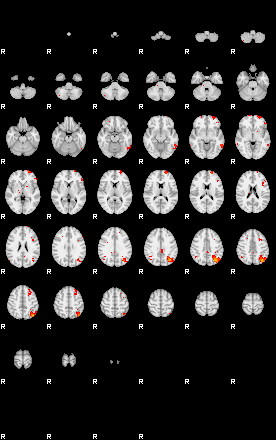 Patients 29671 62