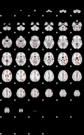 Patients 30001 58