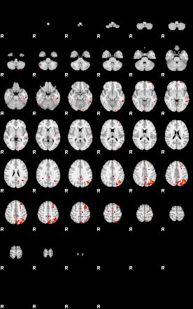 Patients 30011 66