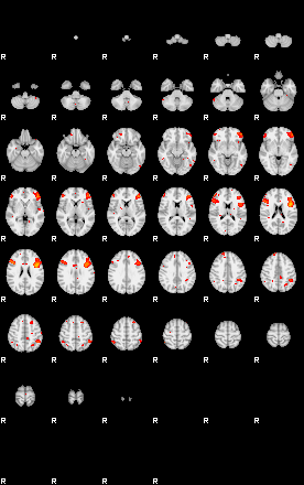 Patients 29205 33