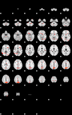 Patients 29613 97