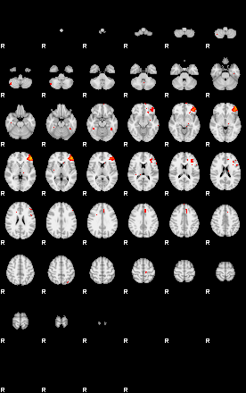 Patients 28790 29