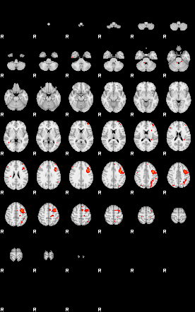 Patients 29292 193