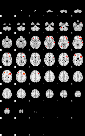 Patients 29293 191