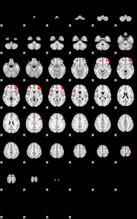 Patients 29168 33