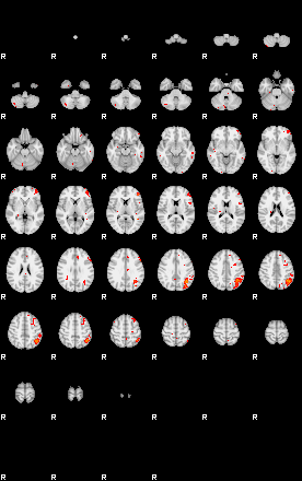 Patients 28930 30