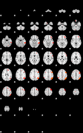 Patients 29160 99