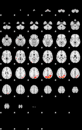 Patients 29102 59