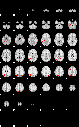 Patients 29220 159