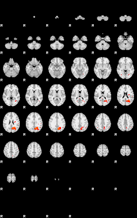 Patients 29503 134