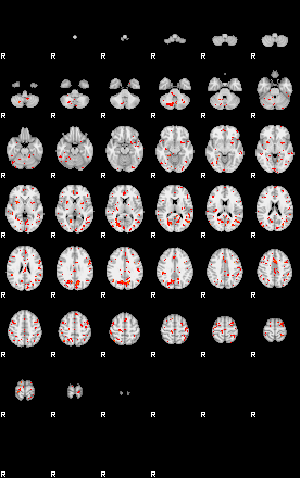 Patients 29615 140