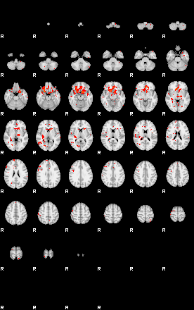 Patients 29013 200