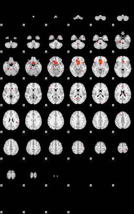 Patients 29187 33