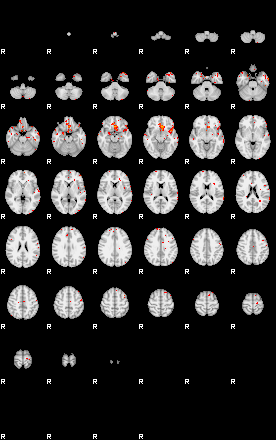 Patients 29515 168