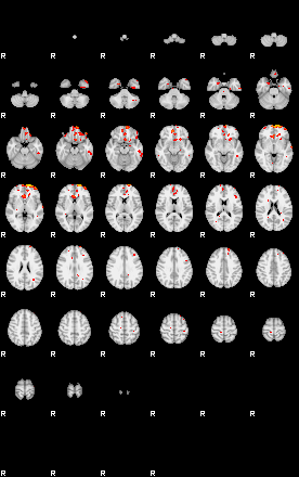 Patients 29662 5