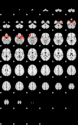 Patients 29881 30