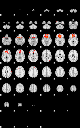 Patients 29180 142