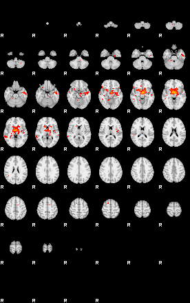 Patients 28815 99