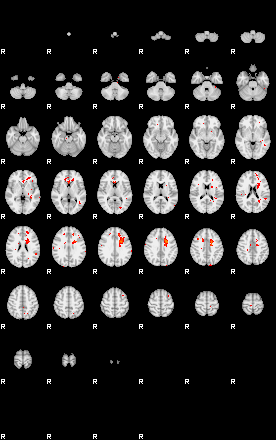 Patients 29007 5