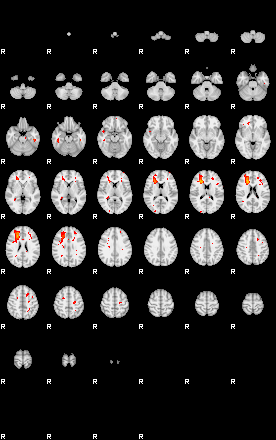 Patients 29152 20