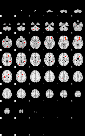 Patients 28694 194