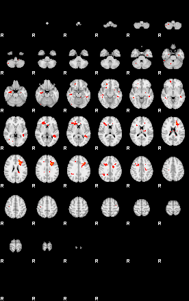 Patients 28696 195