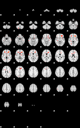 Patients 28940 193