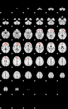 Patients 28963 193