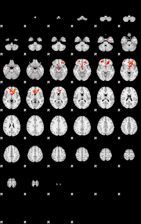 Patients 29010 156