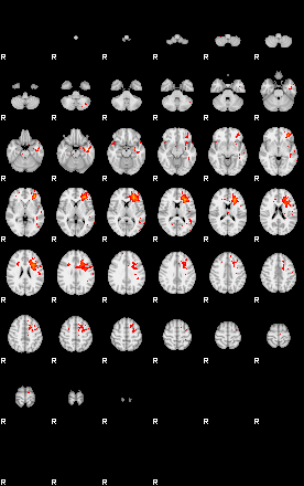 Patients 29010 162