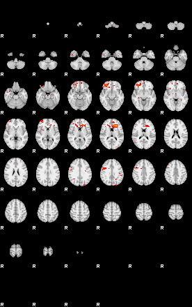 Patients 29017 119