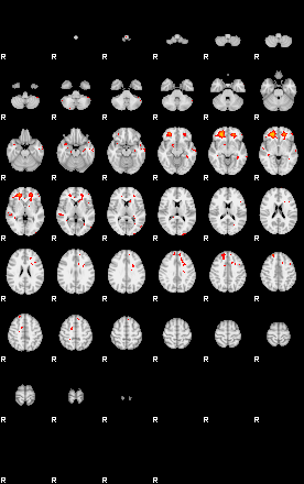 Patients 29029 119