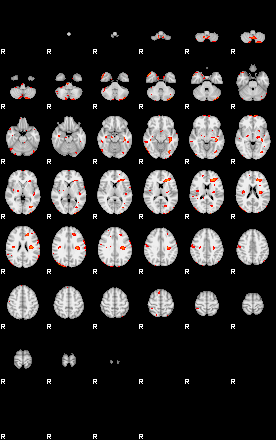 Patients 29113 93