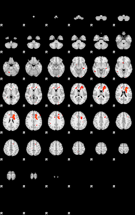 Patients 29153 179