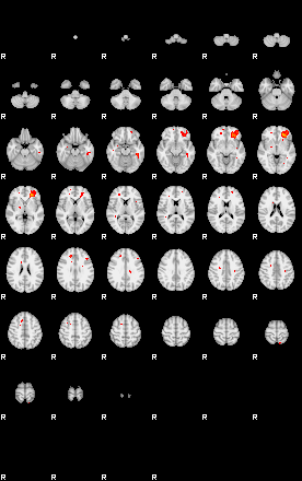 Patients 29159 197