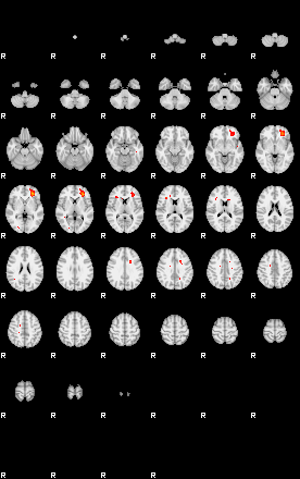 Patients 29161 151