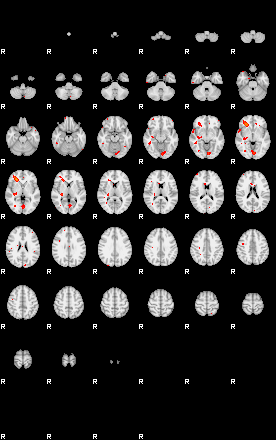 Patients 29162 127