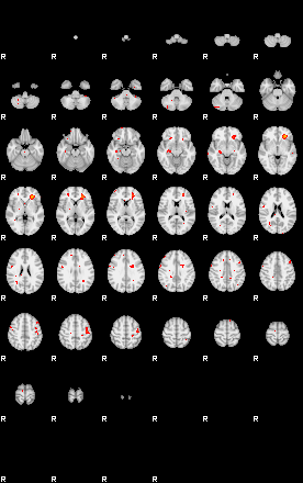 Patients 29162 163