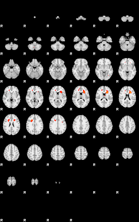 Patients 29171 181