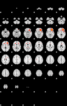 Patients 29174 23