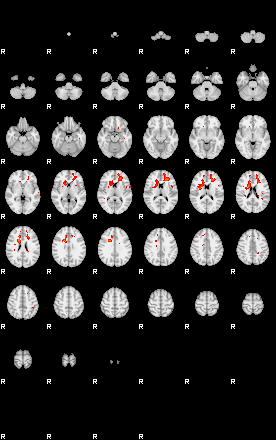 Patients 29176 27