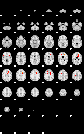 Patients 29200 188