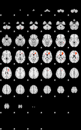 Patients 29201 154