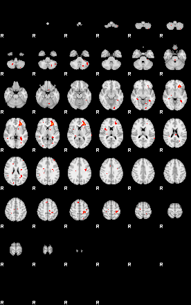 Patients 29203 162