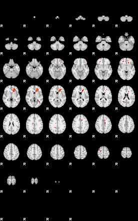 Patients 29212 14