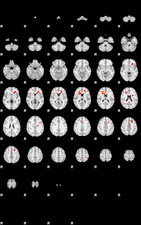 Patients 29218 35