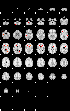 Patients 29375 3